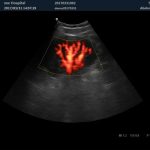 Zoncare Q-7 Color Doppler 3D/4D Ultrasound Machine
