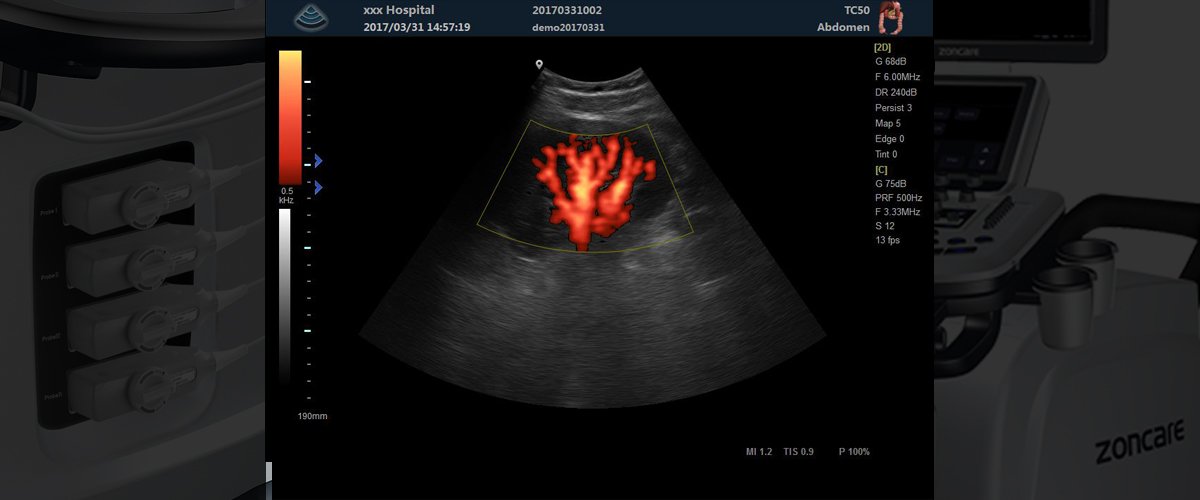 1-1F913110244416.jpg Zoncare Q-7 Color Doppler 3D/4D Ultrasound Machine - Image 1