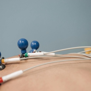 12 Channel ECG Thumbnail