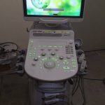 Toshiba Xario 100 Ultrasound Machine - Refurbished