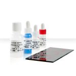 Biolade Widal Test Kit – TO, TH, AH, BH