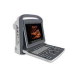 CHISON ECO-2 Color Digital Ultrasound Machine