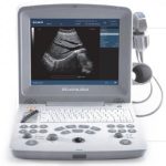 Ultrasound Portable EDAN DUS-60