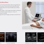 MINDRAY DP-30 Portable Ultrasound