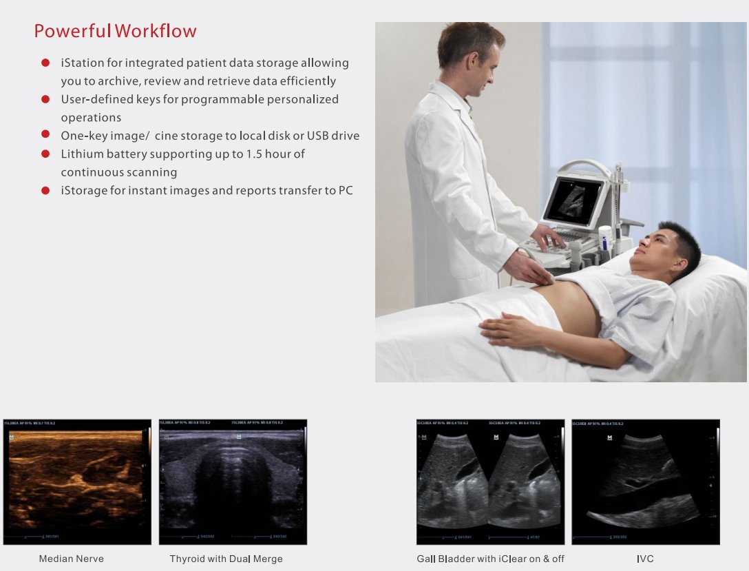 Mindray-DP-30-portable-ultrasound-system-4.jpg MINDRAY DP-30 Portable Ultrasound - Image 1