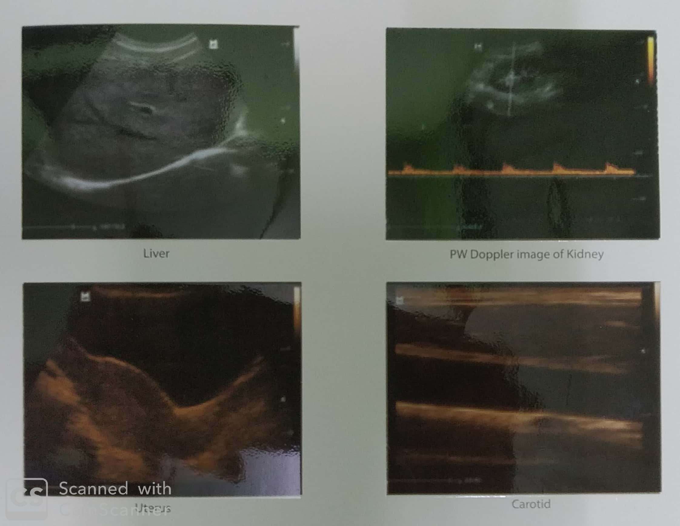 New-Doc-2019-12-12-14.04.25_2.jpg Mindray DP-25 Power Digital Ultrasonic Imaging System - Image 1