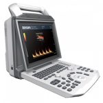 Portable ultrasound system zoncare-i50 with convex probe