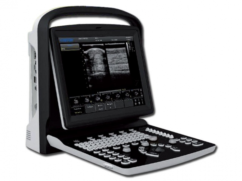 chisoneco1plusportableultrasoundmachine-800x600-1.jpg Chison ECO-1 Portable Ultrasound - Image 1