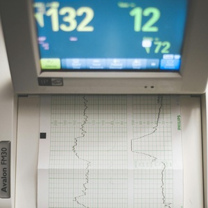 ECG Accessories