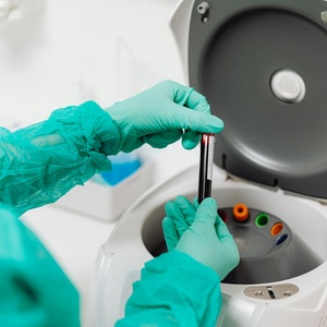 Hematology Analyzer