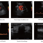 Mindray DP-30 Power Digital Ultrasonic Imaging System