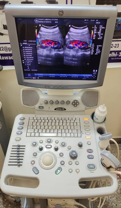 images-3.jpg GE Logiq P5 Ultrasound Machine - Image 1