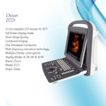 CHISON EC01 ULTRASOUND
