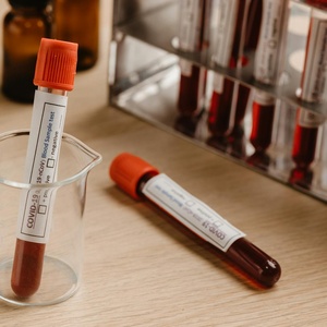 Serology Test Kit