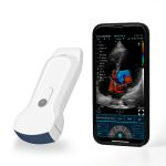 Dual-Probes Multipurpose Wireless Ultrasound – Convex + linear + Cardiac Probe