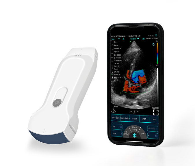 wireless-usg-C10TX-3.jpeg Dual-Probes Multipurpose Wireless Ultrasound – Convex + linear + Cardiac Probe - Image 1