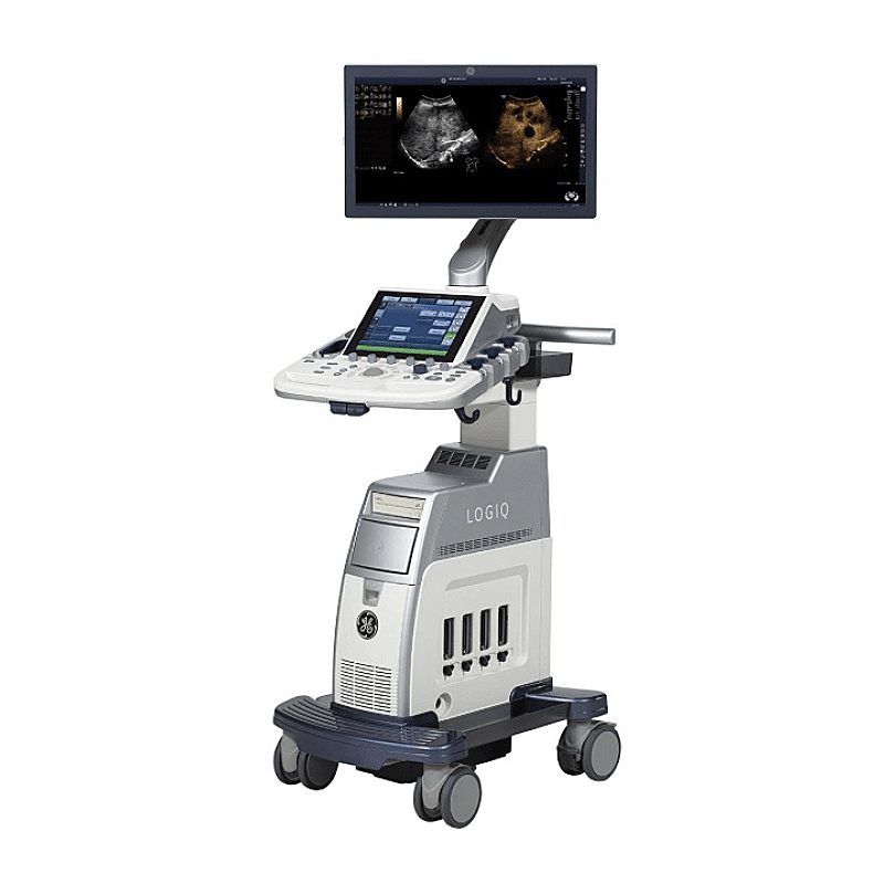 GE-Logiq-P7-1-1 GE Logiq P7 Ultrasound Machine - Refurbished - Image 1