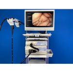 Olympus 150 Endoscopy Machine - Refurbished - Image 2