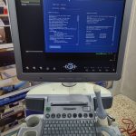GE Voluson S6 Ultrasound Machine -Refurbished